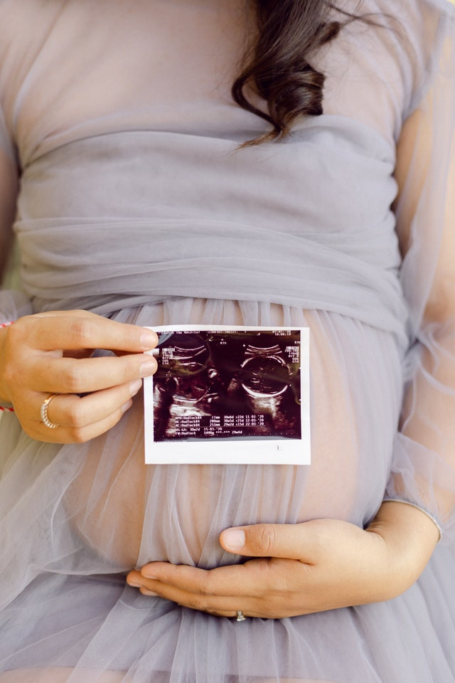 terhes nő ultrahang képpel