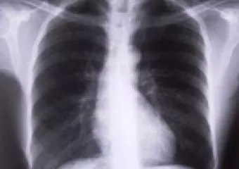 November 18. - COPD Világnap