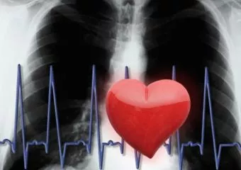 Elindul a szívinfarktus-regiszter