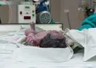 Agyhalott asszony babáját segítették világra a Semmelweis Egyetemen