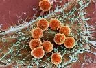 Immunonkológia: új fegyver a daganat elleni harcban