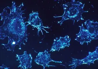 Halálba kergeti a daganatos sejteket egy magyar vezetéssel kifejlesztett új szer