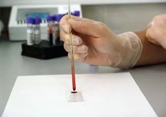 Új felfedezés: vérvizsgálat, mely kimutatja a rákot