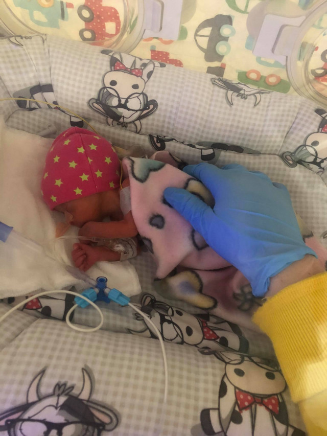 Toxémia: 29 hétre született baba