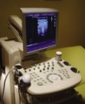 Ultrahangos keringésvizsgálattal megelőzhető a baj